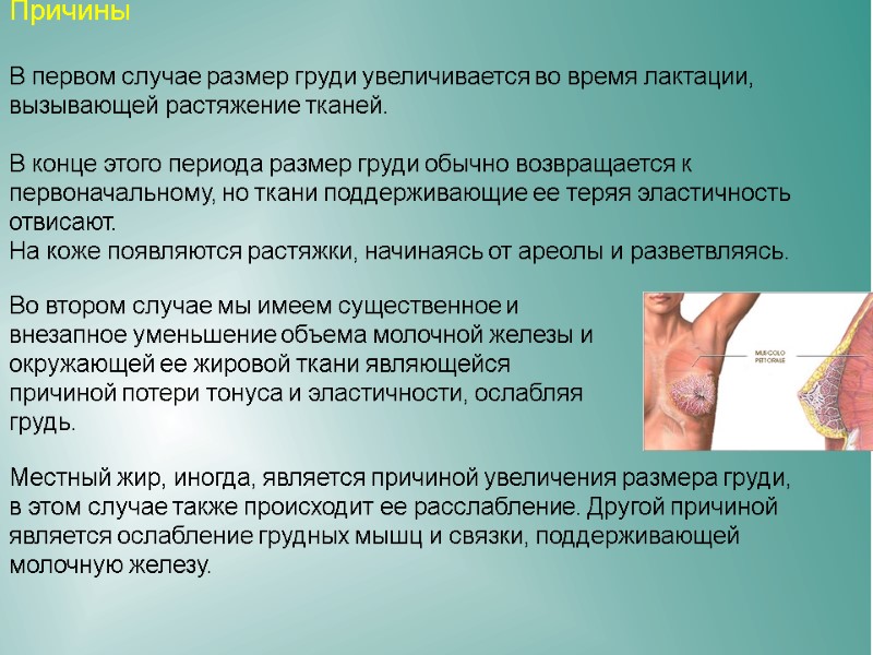 Причины В первом случае размер груди увеличивается во время лактации, вызывающей растяжение тканей. Причины В первом случае размер груди увеличивается во время лактации, вызывающей растяжение тканей.